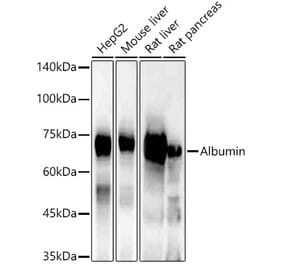 Western Blot - Anti-Albumin Antibody (A92235) - Antibodies.com