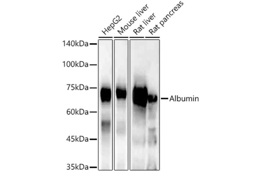 Western Blot - Anti-Albumin Antibody (A92235) - Antibodies.com