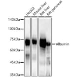 Western Blot - Anti-Albumin Antibody (A92235) - Antibodies.com