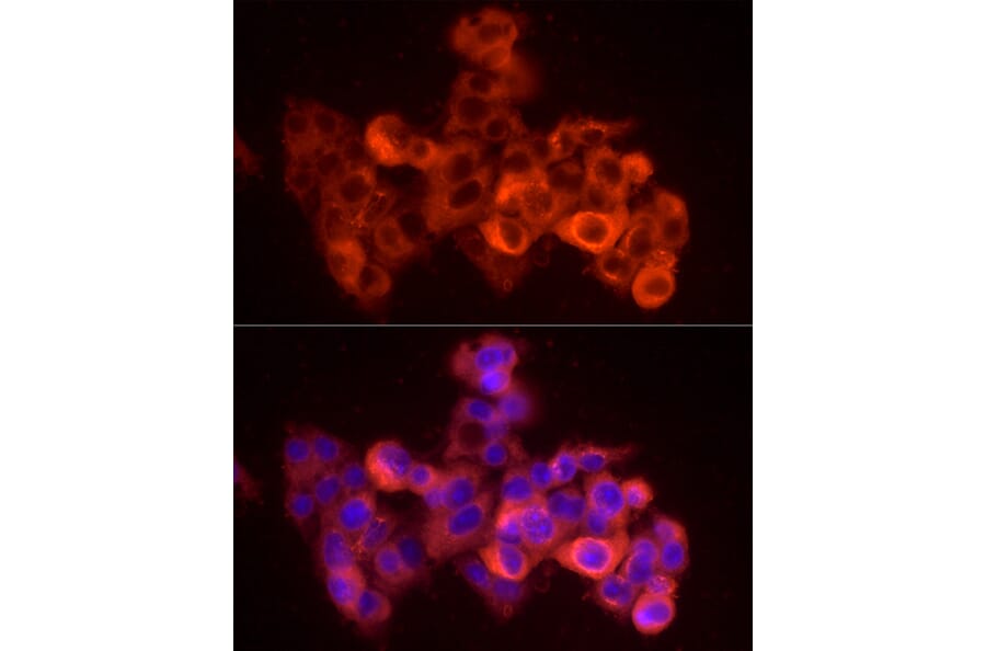 Immunofluorescence - Anti-Albumin Antibody (A92235) - Antibodies.com