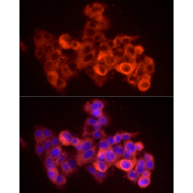 Immunofluorescence - Anti-Albumin Antibody (A92235) - Antibodies.com