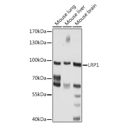Western Blot - Anti-LRP1 Antibody (A92236) - Antibodies.com