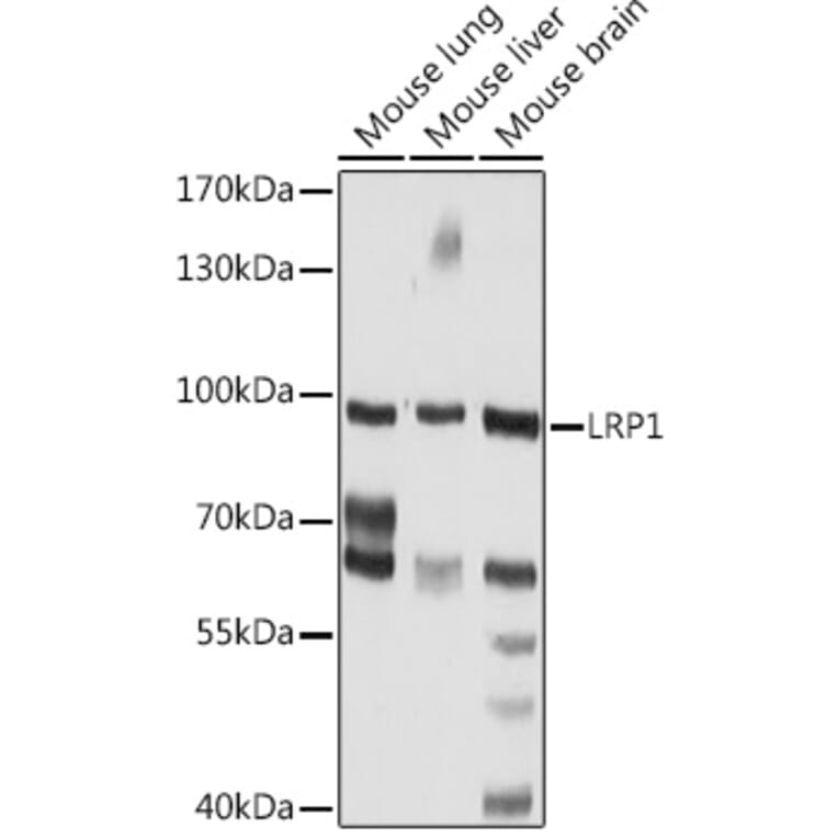 Western Blot - Anti-LRP1 Antibody (A92236) - Antibodies.com