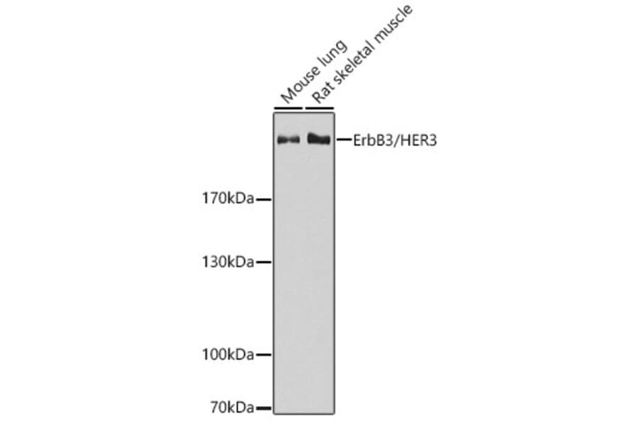 Western Blot - Anti-ErbB3/HER3 Antibody (A92237) - Antibodies.com