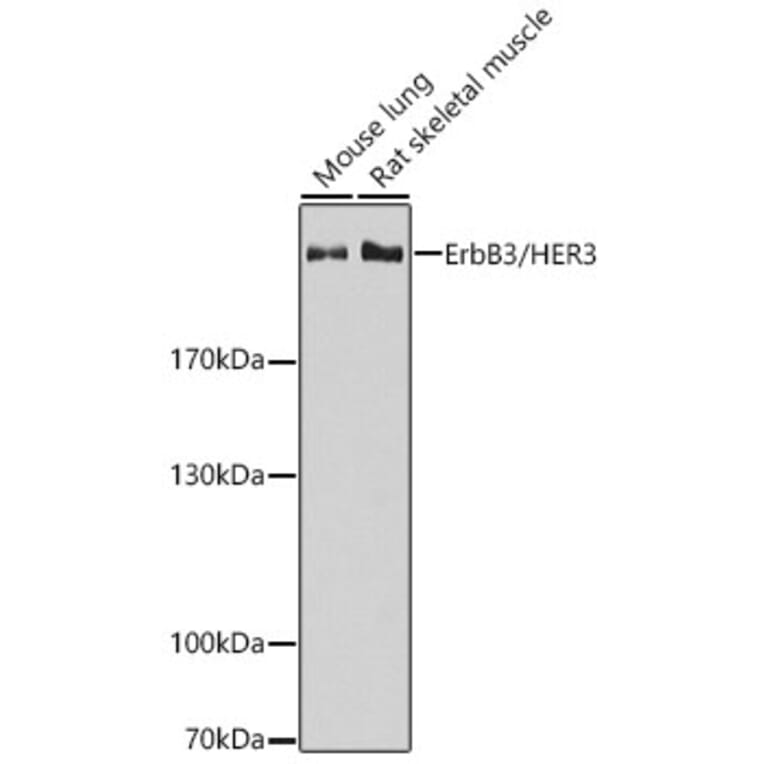 Western Blot - Anti-ErbB3/HER3 Antibody (A92237) - Antibodies.com