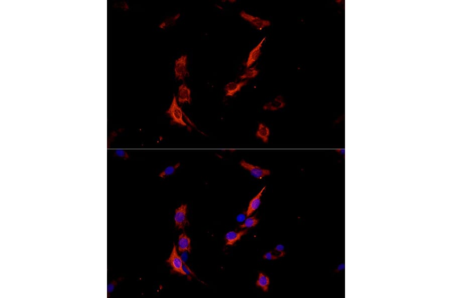 Immunofluorescence - Anti-ErbB3/HER3 Antibody (A92237) - Antibodies.com