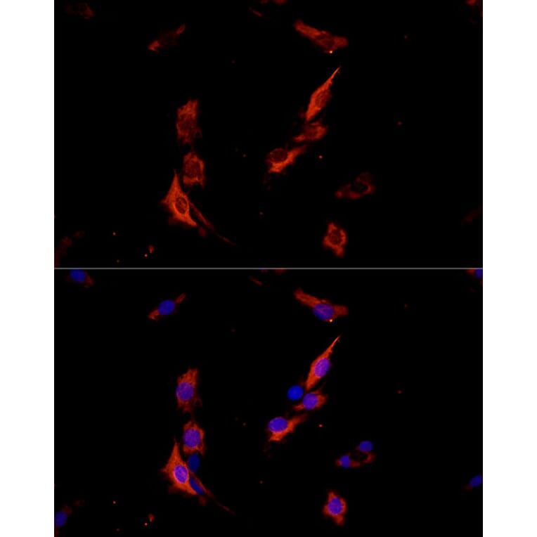 Immunofluorescence - Anti-ErbB3/HER3 Antibody (A92237) - Antibodies.com