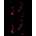 Immunofluorescence - Anti-ErbB3/HER3 Antibody (A92237) - Antibodies.com