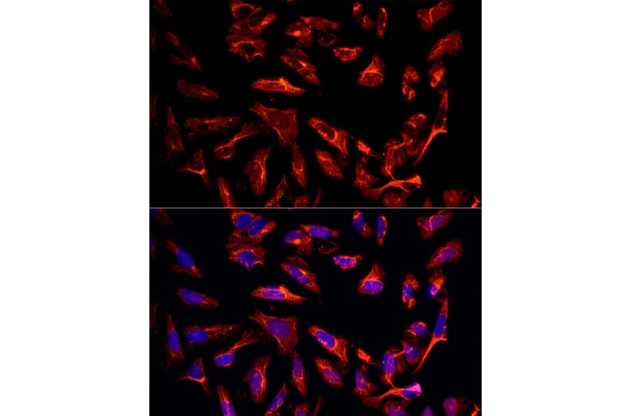 Immunofluorescence - Anti-ErbB3/HER3 Antibody (A92237) - Antibodies.com