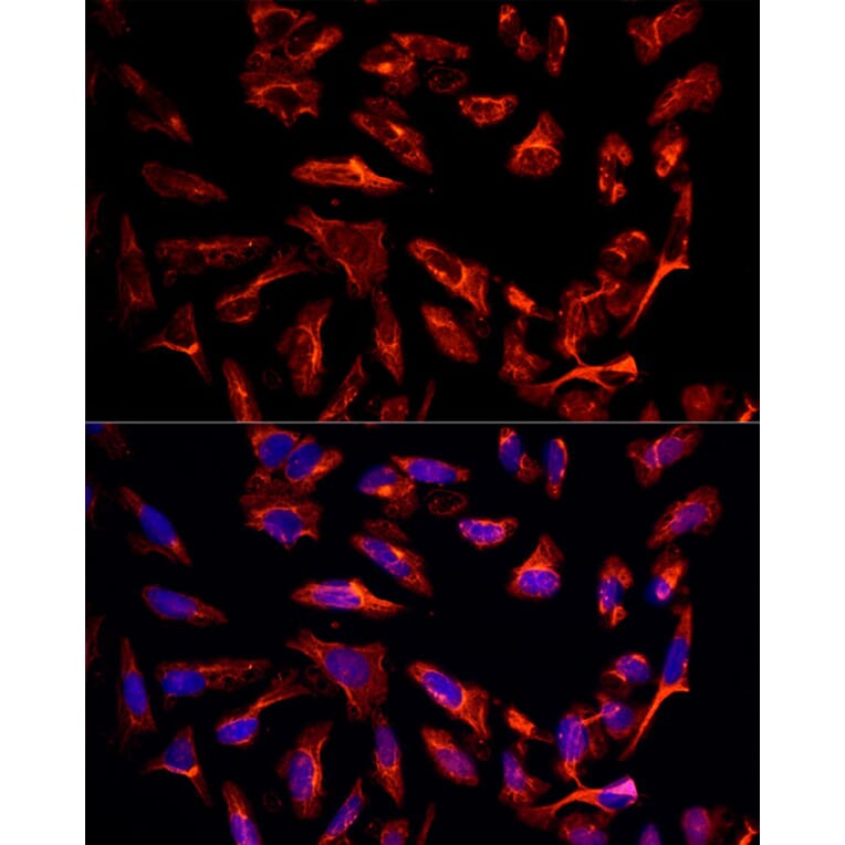 Immunofluorescence - Anti-ErbB3/HER3 Antibody (A92237) - Antibodies.com
