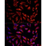 Immunofluorescence - Anti-ErbB3/HER3 Antibody (A92237) - Antibodies.com