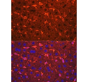 Immunofluorescence - Anti-Ceruloplasmin Antibody (A92238) - Antibodies.com