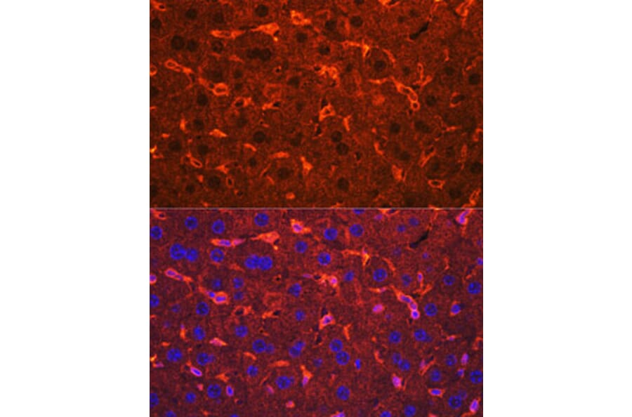 Immunofluorescence - Anti-Ceruloplasmin Antibody (A92238) - Antibodies.com