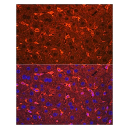 Immunofluorescence - Anti-Ceruloplasmin Antibody (A92238) - Antibodies.com