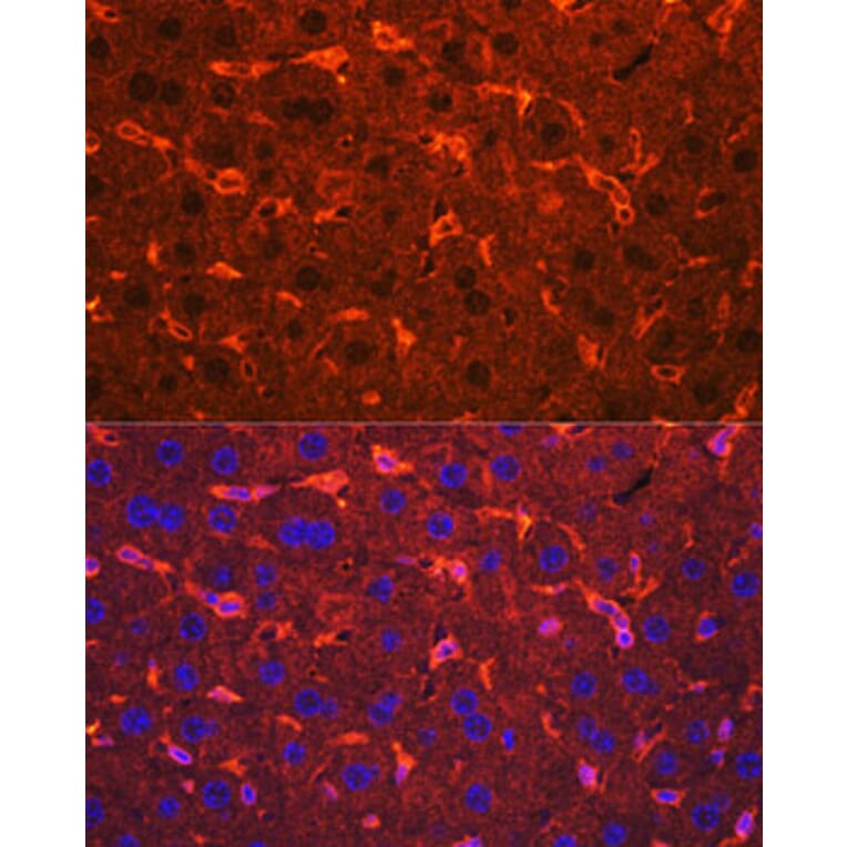 Immunofluorescence - Anti-Ceruloplasmin Antibody (A92238) - Antibodies.com