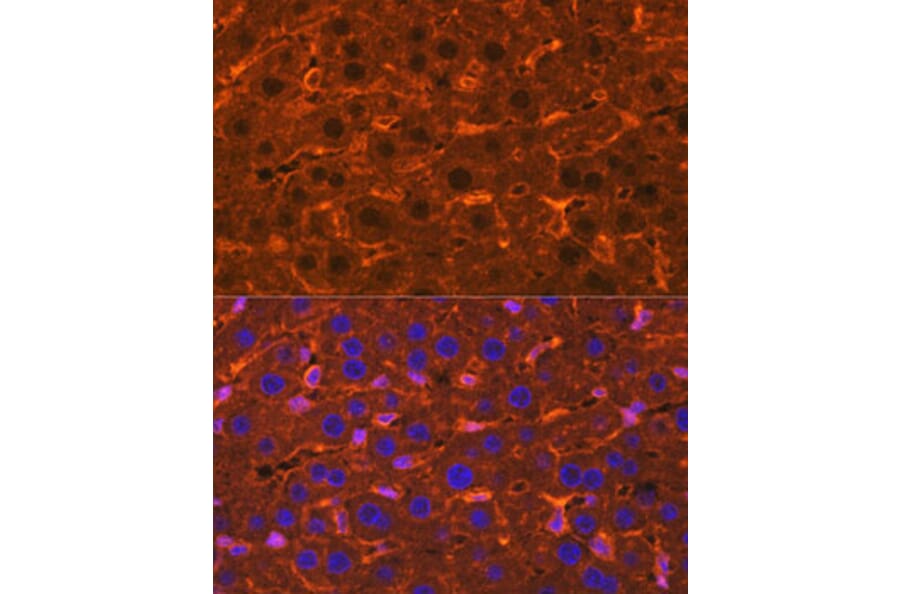 Immunofluorescence - Anti-Ceruloplasmin Antibody (A92238) - Antibodies.com