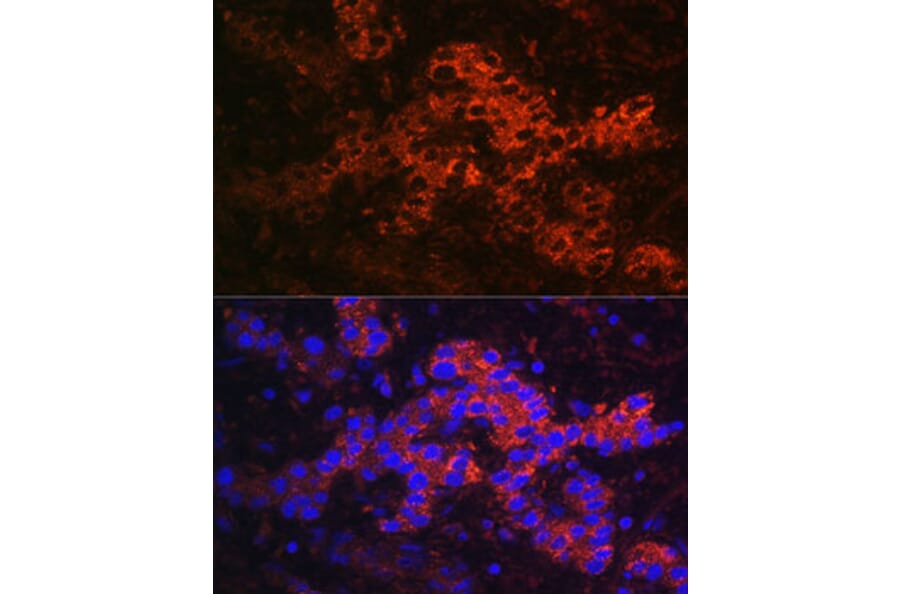 Immunofluorescence - Anti-Ceruloplasmin Antibody (A92238) - Antibodies.com