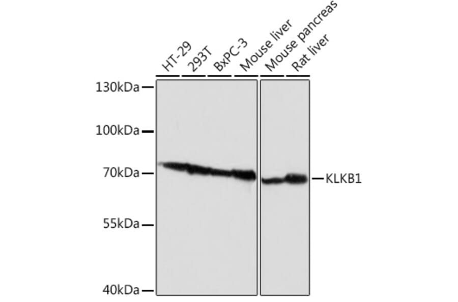 Western Blot - Anti-Plasma Kallikrein 1B Antibody (A92239) - Antibodies.com