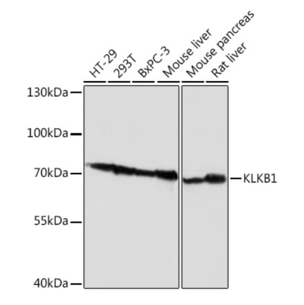 Western Blot - Anti-Plasma Kallikrein 1B Antibody (A92239) - Antibodies.com