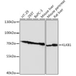 Western Blot - Anti-Plasma Kallikrein 1B Antibody (A92239) - Antibodies.com