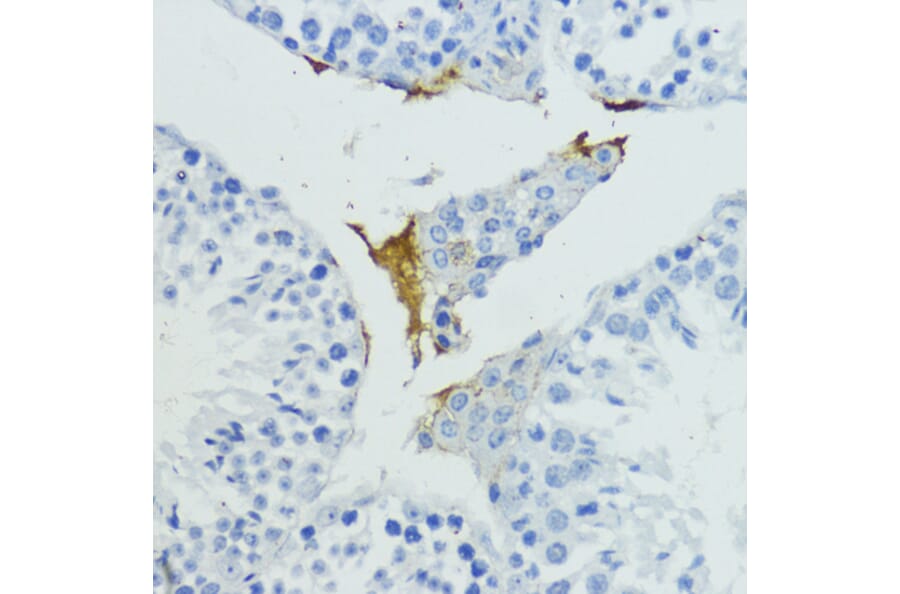 Immunohistochemistry - Anti-Plasma Kallikrein 1B Antibody (A92239) - Antibodies.com