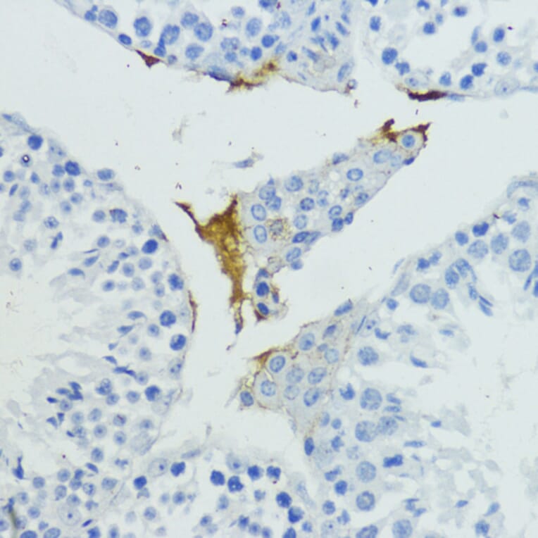 Immunohistochemistry - Anti-Plasma Kallikrein 1B Antibody (A92239) - Antibodies.com