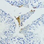 Immunohistochemistry - Anti-Plasma Kallikrein 1B Antibody (A92239) - Antibodies.com