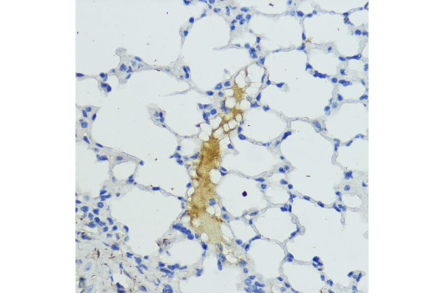 Immunohistochemistry - Anti-Plasma Kallikrein 1B Antibody (A92239) - Antibodies.com