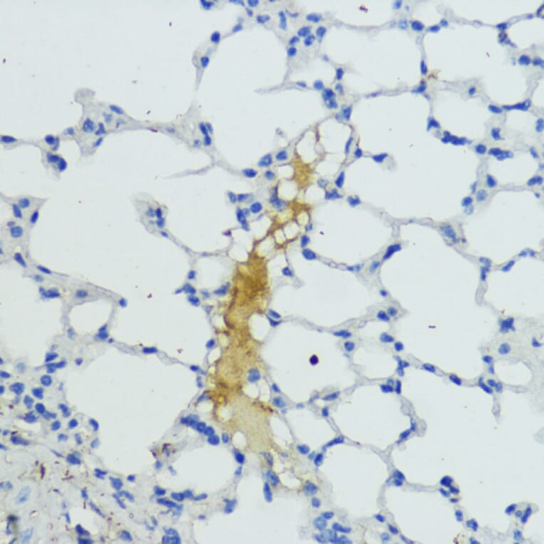 Immunohistochemistry - Anti-Plasma Kallikrein 1B Antibody (A92239) - Antibodies.com