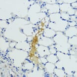 Immunohistochemistry - Anti-Plasma Kallikrein 1B Antibody (A92239) - Antibodies.com