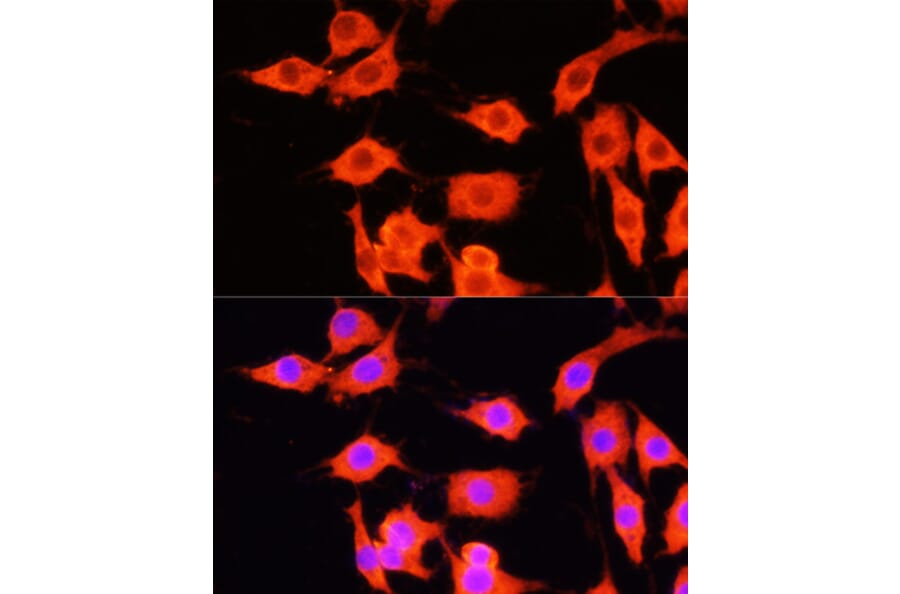 Immunofluorescence - Anti-SERPINA12 Antibody (A14160) - Antibodies.com