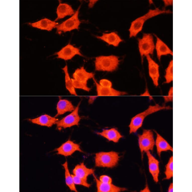 Immunofluorescence - Anti-SERPINA12 Antibody (A14160) - Antibodies.com