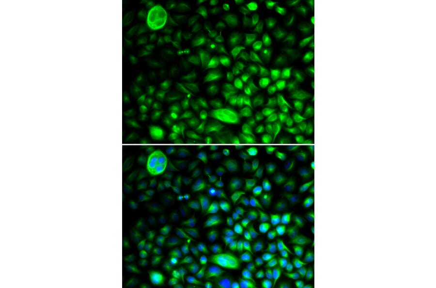 Immunofluorescence - Anti-CACNG2 Antibody (A14101) - Antibodies.com