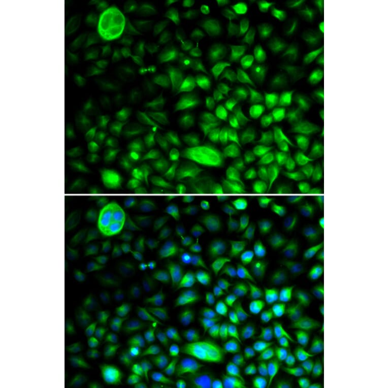 Immunofluorescence - Anti-CACNG2 Antibody (A14101) - Antibodies.com