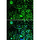 Immunofluorescence - Anti-CACNG2 Antibody (A14101) - Antibodies.com