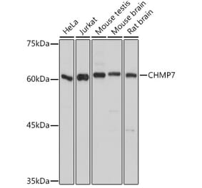 Western Blot - Anti-CHMP7 Antibody (A92245) - Antibodies.com