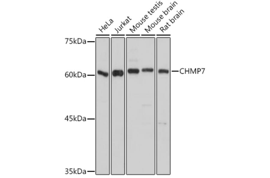 Western Blot - Anti-CHMP7 Antibody (A92245) - Antibodies.com