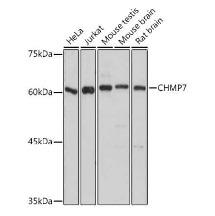Western Blot - Anti-CHMP7 Antibody (A92245) - Antibodies.com