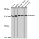 Western Blot - Anti-CHMP7 Antibody (A92245) - Antibodies.com