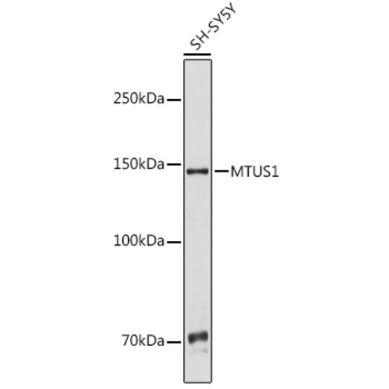 Western Blot - Anti-MTUS1 Antibody (A92247) - Antibodies.com