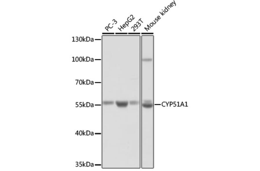 Western Blot - Anti-CYP51A1/CYP51 Antibody (A92250) - Antibodies.com