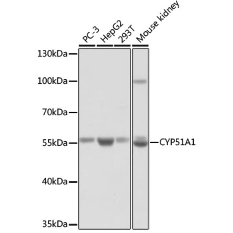 Western Blot - Anti-CYP51A1/CYP51 Antibody (A92250) - Antibodies.com