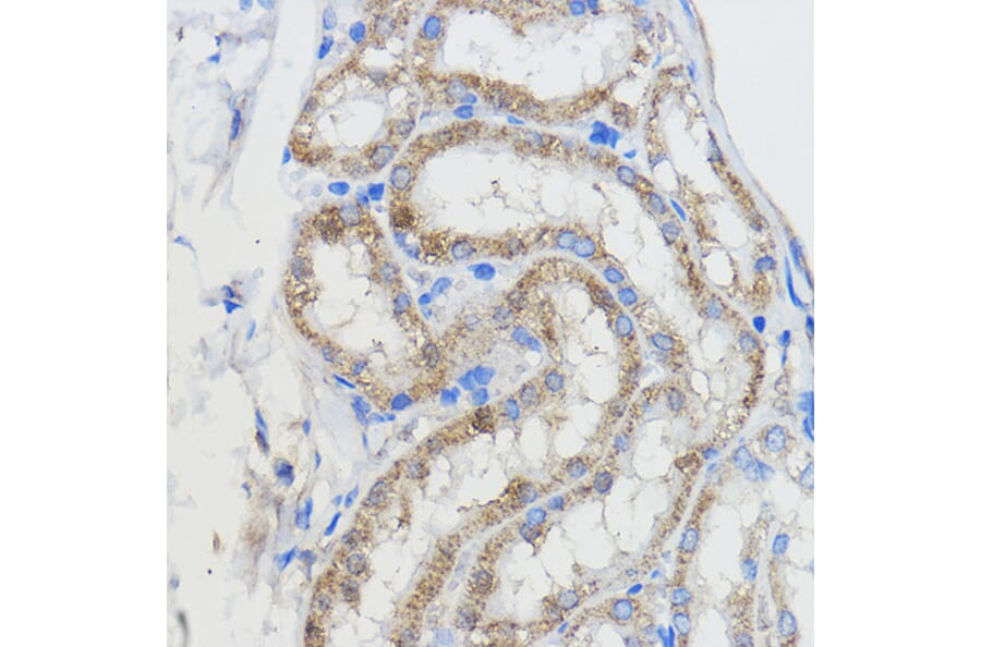 Immunohistochemistry - Anti-CYP51A1/CYP51 Antibody (A92250) - Antibodies.com