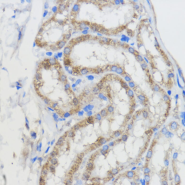 Immunohistochemistry - Anti-CYP51A1/CYP51 Antibody (A92250) - Antibodies.com