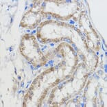 Immunohistochemistry - Anti-CYP51A1/CYP51 Antibody (A92250) - Antibodies.com