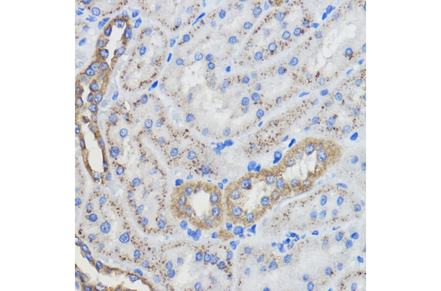 Immunohistochemistry - Anti-CYP51A1/CYP51 Antibody (A92250) - Antibodies.com
