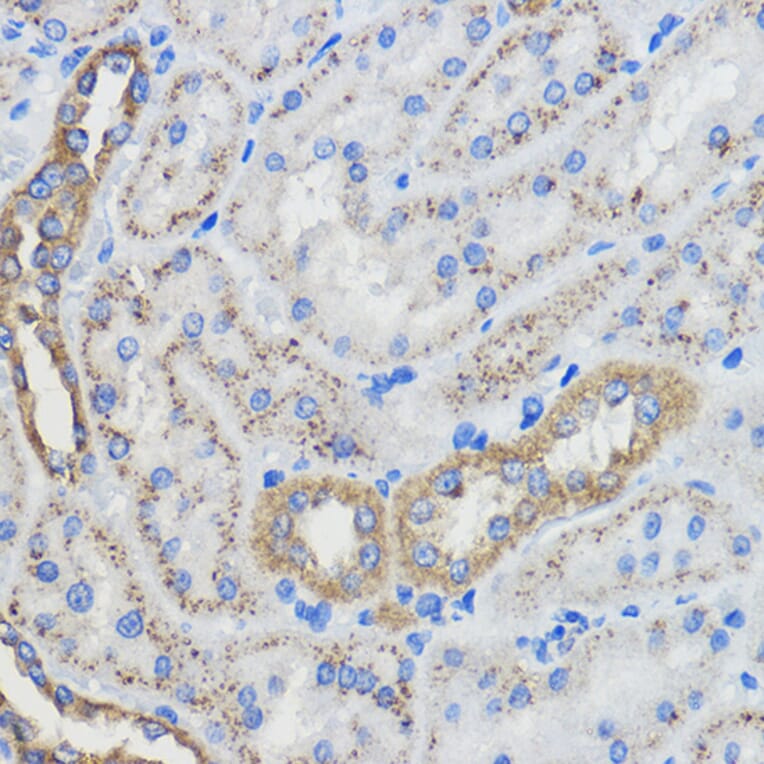 Immunohistochemistry - Anti-CYP51A1/CYP51 Antibody (A92250) - Antibodies.com