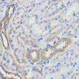 Immunohistochemistry - Anti-CYP51A1/CYP51 Antibody (A92250) - Antibodies.com