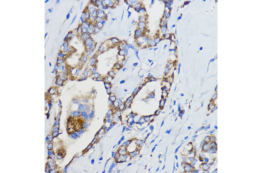 Immunohistochemistry - Anti-CYP51A1/CYP51 Antibody (A92250) - Antibodies.com