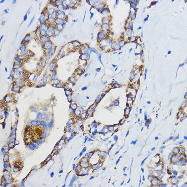 Immunohistochemistry - Anti-CYP51A1/CYP51 Antibody (A92250) - Antibodies.com